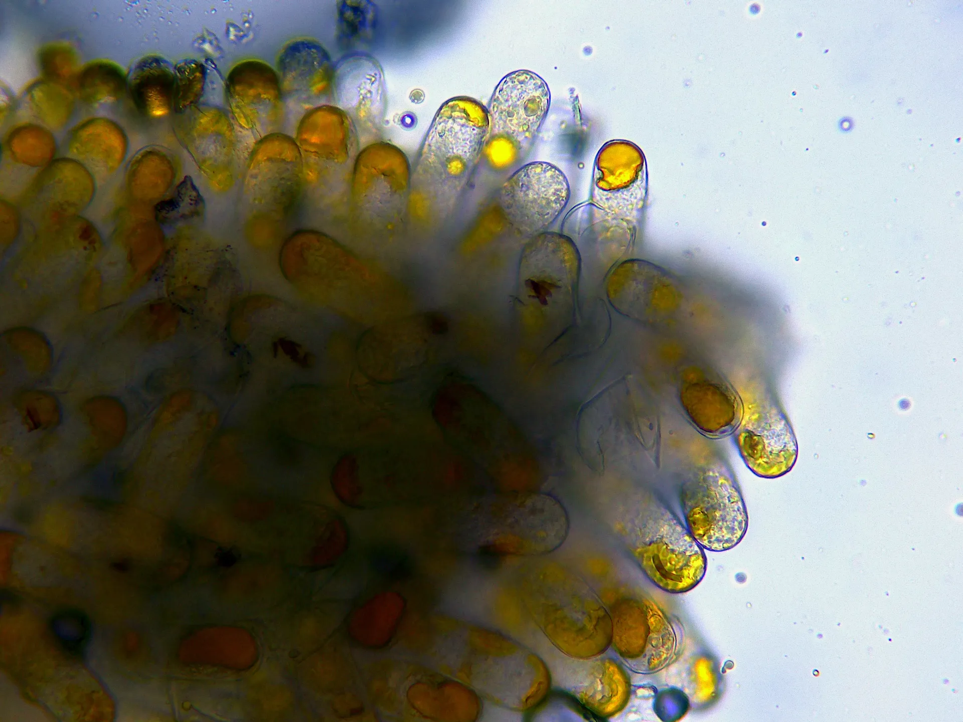 Microscopía de Taphrina populina - 10 - x 400-002